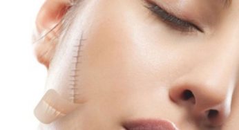 Chia sẻ một số cách điều trị sẹo lồi lâu năm hiệu quả nhất