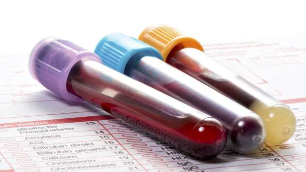 Cách điều trị khi MCV bất thường trong xét nghiệm máu là gì?